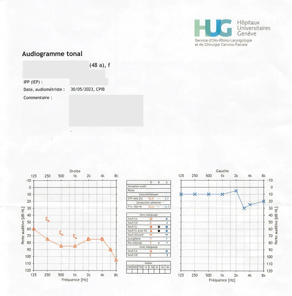Audiogramme après programme