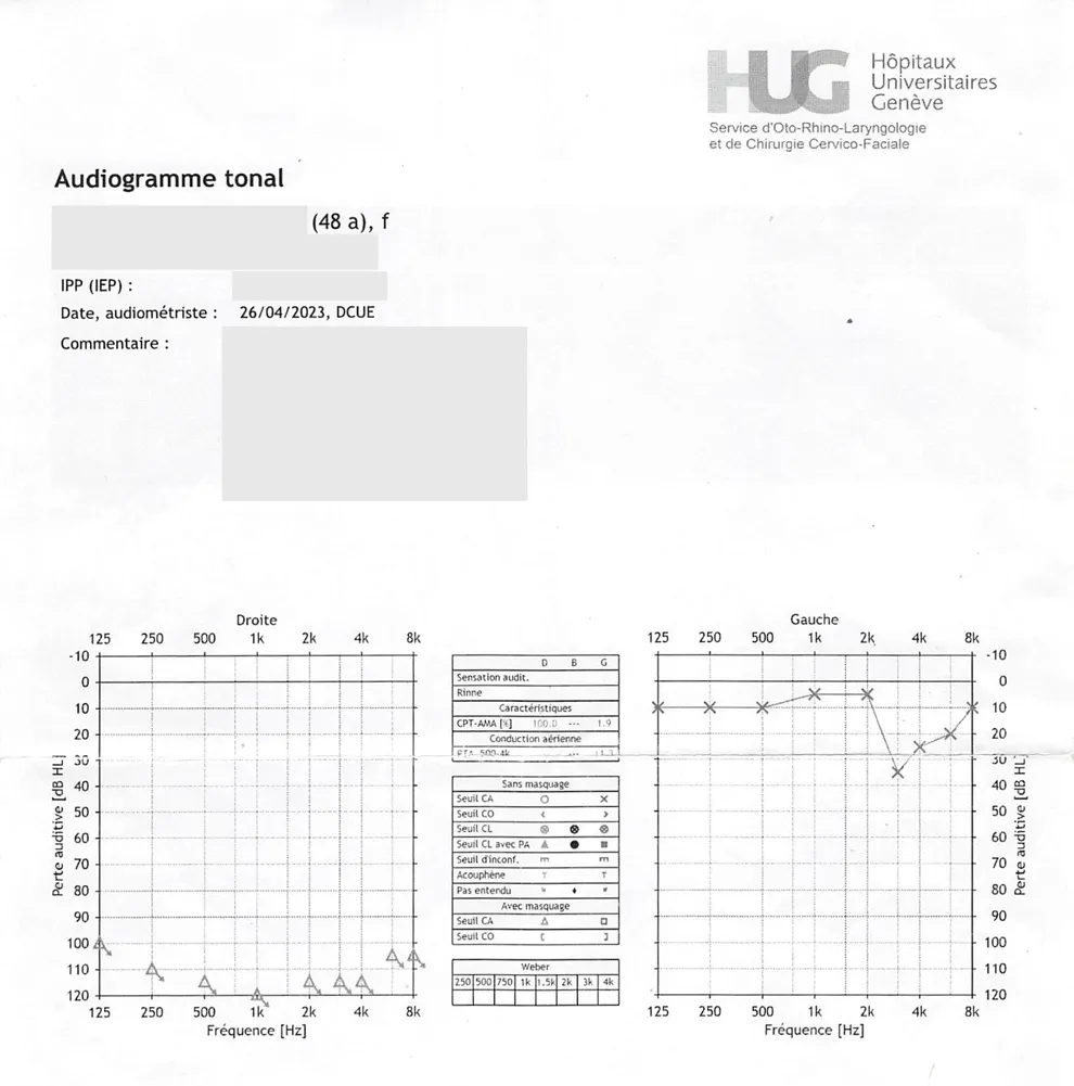 audiogramme-avant-programme